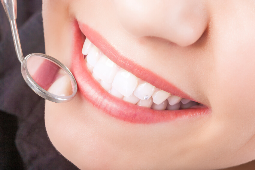 Things to Know Before Going for Cosmetic Dentistry