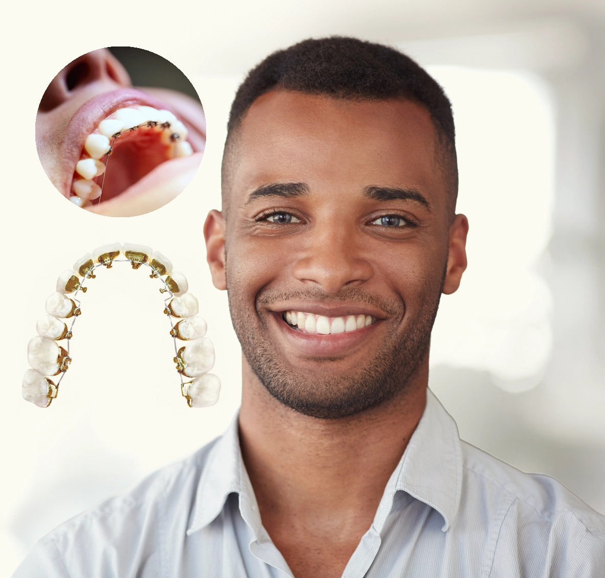 The Best Age to Get Braces According to Experts